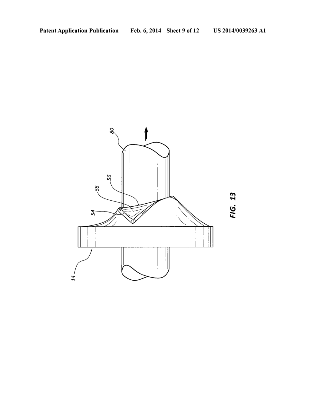 LARGE BORE INTRODUCER WITH IMPROVED SEAL - diagram, schematic, and image 10