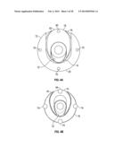 DILATION SYSTEM diagram and image