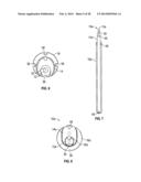 DILATION SYSTEM diagram and image