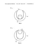 DILATION SYSTEM diagram and image