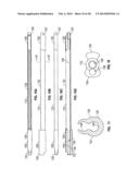 DILATION SYSTEM diagram and image