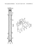 DILATION SYSTEM diagram and image