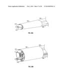 DILATION SYSTEM diagram and image