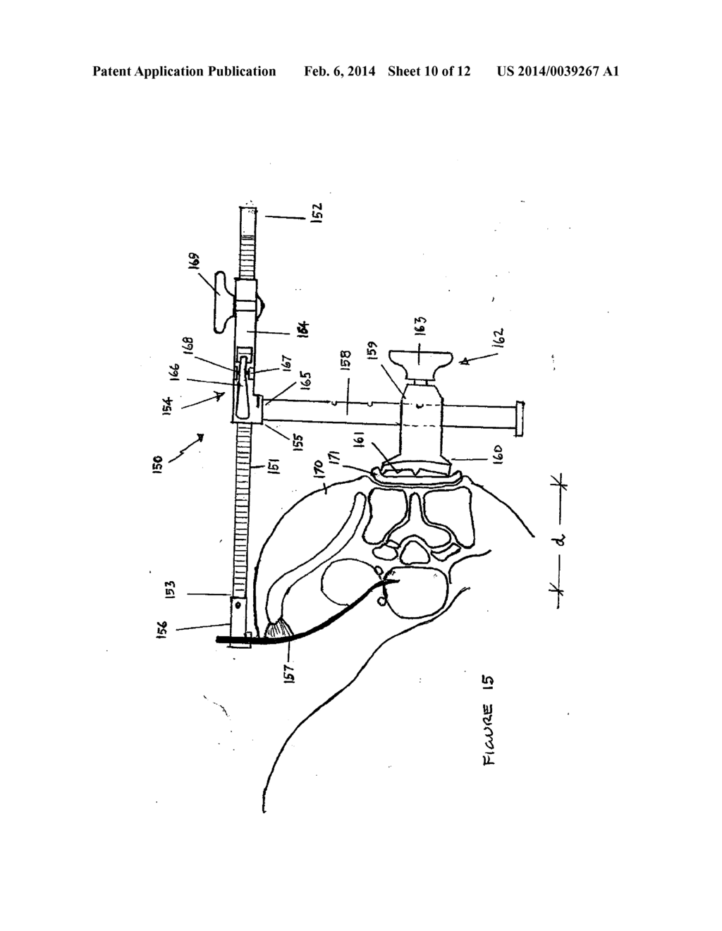 Clamping Retractor Assembly - diagram, schematic, and image 11