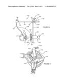 Clamping Retractor Assembly diagram and image