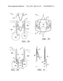 Two-Stage Spinal Access Channel with Psoas Docking diagram and image