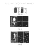 APPARATUS FOR INSERTION OF A MEDICAL DEVICE WITHIN A BODY DURING A MEDICAL     IMAGING PROCESS AND DEVICES AND METHODS RELATED THERETO diagram and image