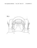 MR Surface Coil with Integrated Automatic Patient Immobilization diagram and image