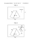 ULTRASOUND DIAGNOSTIC APPARATUS AND METHOD diagram and image