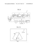 ULTRASOUND DIAGNOSTIC APPARATUS AND METHOD diagram and image