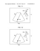 ULTRASOUND DIAGNOSTIC APPARATUS AND METHOD diagram and image