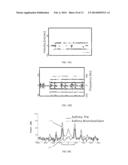 DIAGNOSING LUNG DISEASE USING TRANSTHORACIC PULMONARY DOPPLER  ULTRASOUND     DURING LUNG VIBRATION diagram and image