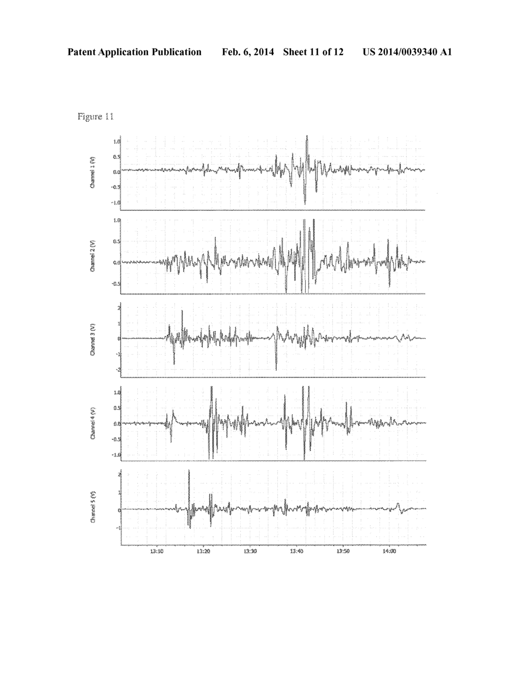 METHODS OF PREDICTING AND MONITORING LABOR - diagram, schematic, and image 12