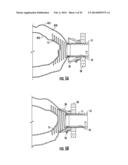 SYSTEMS FOR IMPLANTING AND USING A CONDUIT WITHIN A TISSUE WALL diagram and image