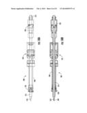 SYSTEMS FOR IMPLANTING AND USING A CONDUIT WITHIN A TISSUE WALL diagram and image