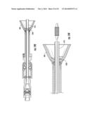 SYSTEMS FOR IMPLANTING AND USING A CONDUIT WITHIN A TISSUE WALL diagram and image