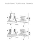 SYSTEMS FOR IMPLANTING AND USING A CONDUIT WITHIN A TISSUE WALL diagram and image