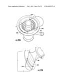 SYSTEMS FOR IMPLANTING AND USING A CONDUIT WITHIN A TISSUE WALL diagram and image