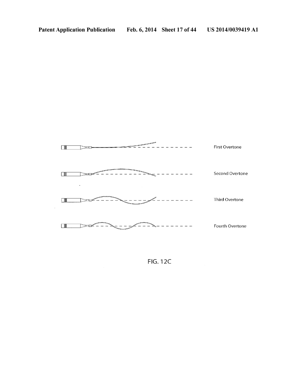 Devices for Clearing Blockages in In-Situ Artificial Lumens - diagram, schematic, and image 18