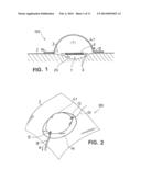 WOUND TREATMENT DEVICE WITH ELASTICALLY DEFORMABLE VACUUM PRODUCING     ELEMENT diagram and image