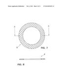 WOUND TREATMENT DEVICE WITH ELASTICALLY DEFORMABLE VACUUM PRODUCING     ELEMENT diagram and image