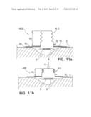 WOUND TREATMENT DEVICE WITH ELASTICALLY DEFORMABLE VACUUM PRODUCING     ELEMENT diagram and image