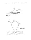 WOUND TREATMENT DEVICE WITH ELASTICALLY DEFORMABLE VACUUM PRODUCING     ELEMENT diagram and image