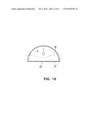 WOUND TREATMENT DEVICE WITH ELASTICALLY DEFORMABLE VACUUM PRODUCING     ELEMENT diagram and image