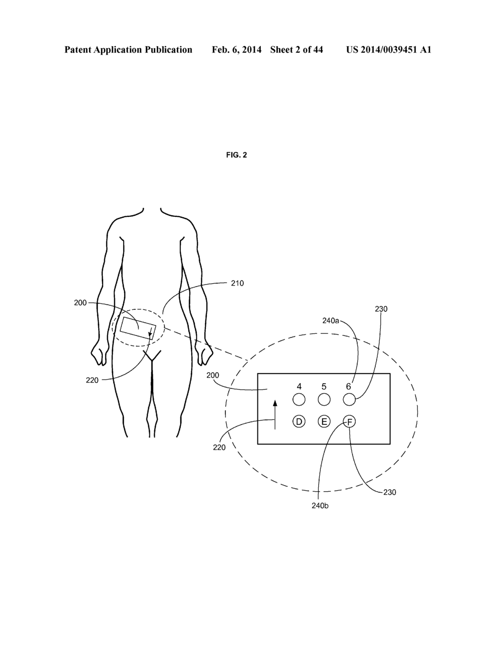 DEVICES AND METHODS FOR WEARABLE INJECTION GUIDES - diagram, schematic, and image 03