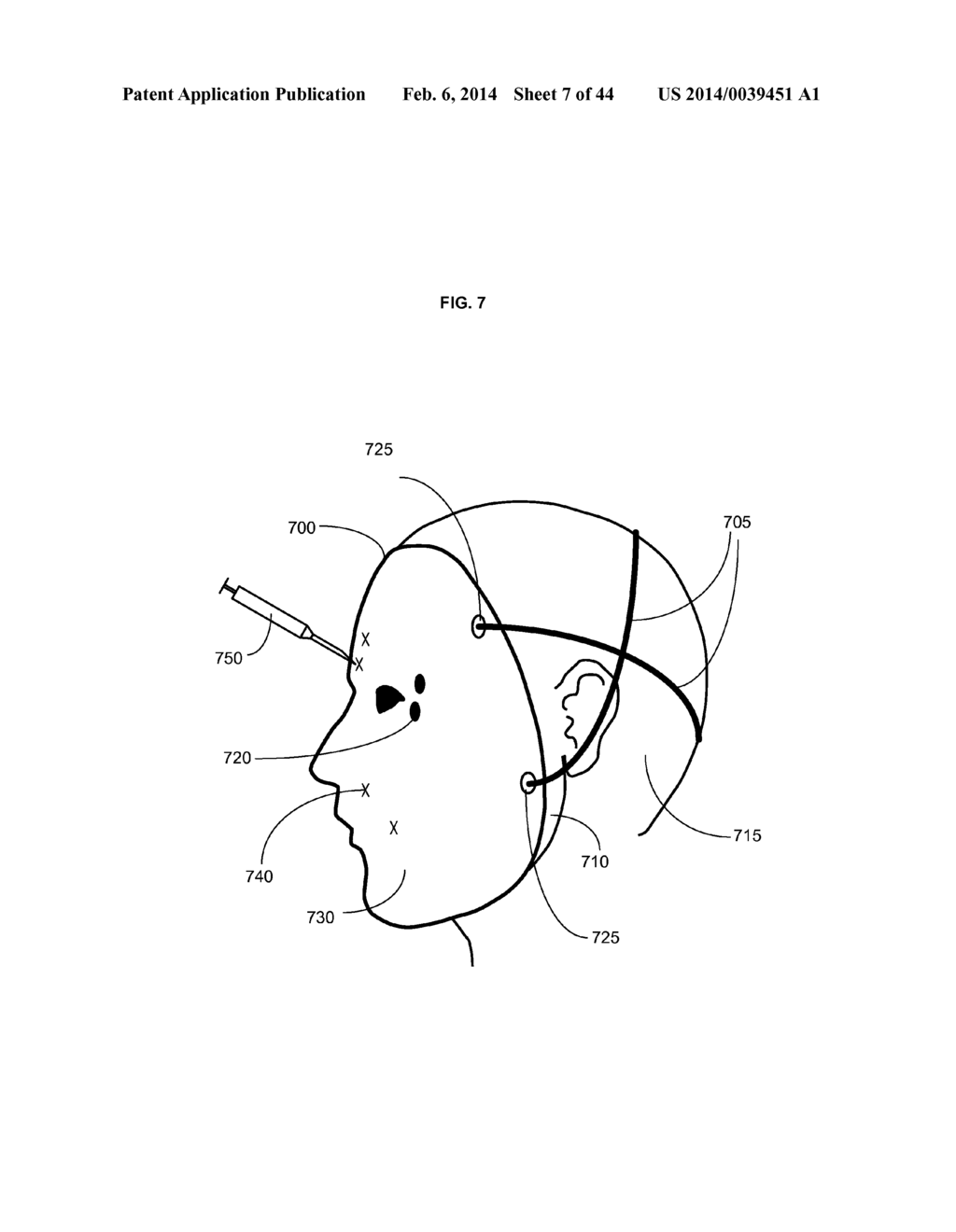 DEVICES AND METHODS FOR WEARABLE INJECTION GUIDES - diagram, schematic, and image 08