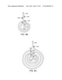 INFUSION SET IMPROVEMENTS diagram and image