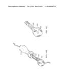 INFUSION SET IMPROVEMENTS diagram and image