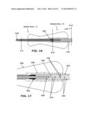 Therapeutic Cryoablation System diagram and image