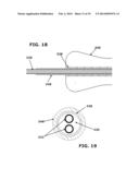 Therapeutic Cryoablation System diagram and image