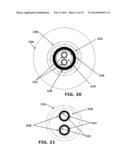 Therapeutic Cryoablation System diagram and image