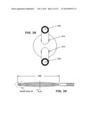 Therapeutic Cryoablation System diagram and image