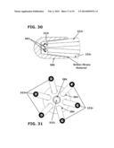 Therapeutic Cryoablation System diagram and image