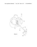 CARDIAC ABLATION DEVICES AND METHODS diagram and image