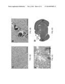 ACUTE BLOOD-BRAIN BARRIER DISRUPTION USING ELECTRICAL ENERGY BASED THERAPY diagram and image