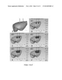 ACUTE BLOOD-BRAIN BARRIER DISRUPTION USING ELECTRICAL ENERGY BASED THERAPY diagram and image