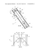 SURGICAL INSTRUMENTS AND METHODS OF USE diagram and image