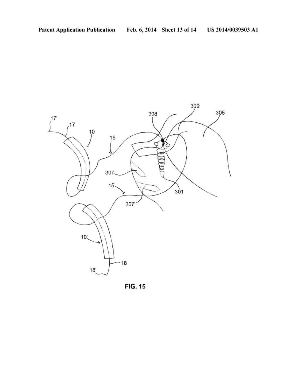 SURGICAL INSTRUMENTS AND METHODS OF USE - diagram, schematic, and image 14