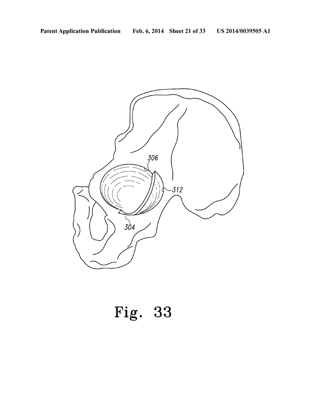 RECIPROCATING RASPS FOR USE IN AN ORTHOPAEDIC SURGICAL PROCEDURE - diagram, schematic, and image 22