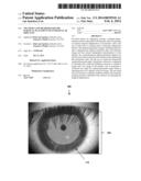 TPS TOOLS AND METHODS FOR THE SURGICAL PLACEMENT OF INTRAOCULAR IMPLANTS diagram and image