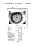 TPS TOOLS AND METHODS FOR THE SURGICAL PLACEMENT OF INTRAOCULAR IMPLANTS diagram and image