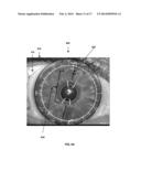 TPS TOOLS AND METHODS FOR THE SURGICAL PLACEMENT OF INTRAOCULAR IMPLANTS diagram and image