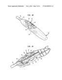 APPARATUS AND METHOD FOR HEART VALVE REPAIR diagram and image