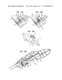 APPARATUS AND METHOD FOR HEART VALVE REPAIR diagram and image