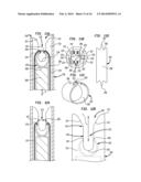 APPARATUS AND METHOD FOR HEART VALVE REPAIR diagram and image