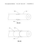 LOW PROFILE ELECTRODES FOR AN ANGIOPLASTY SHOCK WAVE CATHETER diagram and image